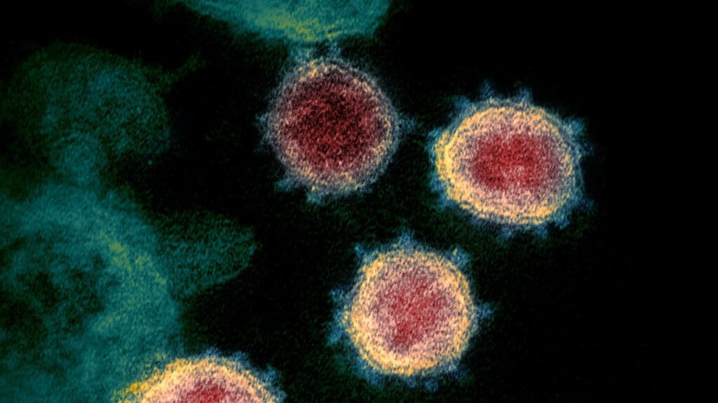 In Italy, a person got HIV, Corona and monkeypox together! Even the doctors were puzzled